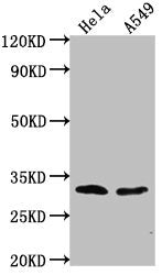 Western Blot Positive WB detected in: Hela whole cell lysate, A549 whole cell lysate All lanes: VAX2 antibody at 1:2000 Secondary Goat polyclonal to rabbit IgG at 1/50000 dilution Predicted band size: 31 kDa Observed band size: 31 kDa