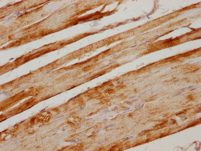 IHC image of CSB-PA025821PA01HU diluted at 1:300 and staining in paraffin-embedded human skeletal muscle tissue performed on a Leica BondTM system. After dewaxing and hydration, antigen retrieval was mediated by high pressure in a citrate buffer (...