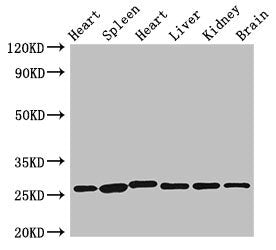 Western Blot Positive WB detected in: Rat heart tissue, Rat spleen tissue, Mouse heart tissue, Mouse liver tissue, Mouse kidney tissue, Mouse brain tissue All lanes: VEGFB antibody at 3.5µg/ml Secondary Goat polyclonal to rabbit IgG at 1/50000 dil...