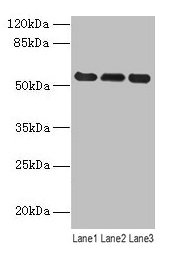 Western blot All lanes: VIM antibody at 8µg/ml Lane 1: Hela whole cell lysate Lane 2: Jurkat whole cell lysate Lane 3: A549 whole cell lysate Secondary Goat polyclonal to rabbit IgG at 1/10000 dilution Predicted band size: 54 kDa Observed band siz...