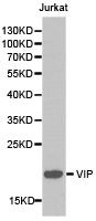 Western blot analysis of extracts of Jurkat cell lines, using VIP antibody.