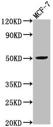 Western Blot Positive WB detected in: MCF-7 whole cell lysate All lanes: VIPR2 antibody at 1:2000 Secondary Goat polyclonal to rabbit IgG at 1/50000 dilution Predicted band size: 50, 47 kDa Observed band size: 50 kDa
