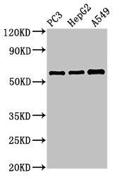 Western Blot Positive WB detected in: PC-3 whole cell lysate, HepG2 whole cell lysate, A549 whole cell lysate All lanes: vnn1 antibody at 3.4ug/ml Secondary Goat polyclonal to rabbit IgG at 1/50000 dilution Predicted band size: 58 kDa Observed ban...