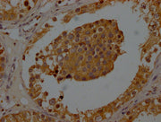 IHC image of CSB-PA025898LA01HU diluted at 1:200 and staining in paraffin-embedded human testis tissue performed on a Leica BondTM system. After dewaxing and hydration, antigen retrieval was mediated by high pressure in a citrate buffer (pH 6.0)....