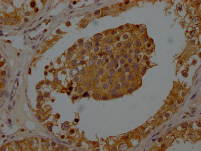 IHC image of CSB-PA025898LA01HU diluted at 1:200 and staining in paraffin-embedded human testis tissue performed on a Leica BondTM system. After dewaxing and hydration, antigen retrieval was mediated by high pressure in a citrate buffer (pH 6.0)....