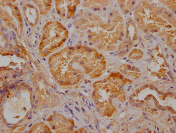 IHC image of CSB-PA025898LA11HU diluted at 1:300 and staining in paraffin-embedded human kidney tissue performed on a Leica BondTM system. After dewaxing and hydration, antigen retrieval was mediated by high pressure in a citrate buffer (pH 6.0)....