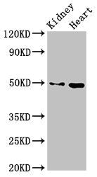 Western Blot Positive WB detected in: Mouse kidney tissue, Mouse heart tissue All lanes: MYC antibody at 2.7ug/ml Secondary Goat polyclonal to rabbit IgG at 1/50000 dilution Predicted band size: 49 kDa Observed band size: 49 kDa