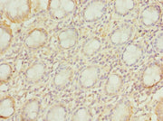Immunohistochemistry of paraffin-embedded human colon tissue using CSB-PA025933DSR2HU at dilution of 1:100