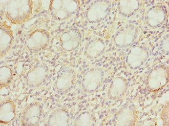 Immunohistochemistry of paraffin-embedded human colon tissue using CSB-PA025933DSR2HU at dilution of 1:100