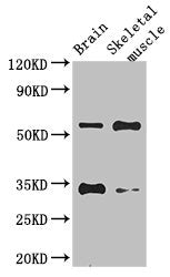 Western Blot Positive WB detected in: Mouse brain tissue, Mouse skeletal muscle tissue All lanes: VTN antibody at 1:700 Secondary Goat polyclonal to rabbit IgG at 1/50000 dilution Predicted band size: 55 kDa Observed band size: 55, 34 kDa