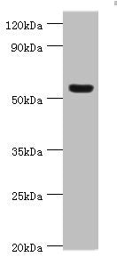 Western blot All lanes: Vitronectin antibody at 12ug/ml + HepG2 whole cell lysate Secondary Goat polyclonal to rabbit IgG at 1/10000 dilution Predicted band size: 54 kDa Observed band size: 54 kDa