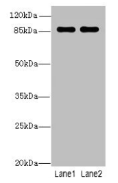 Western blot All lanes: VWA5A antibody at 1µg/ml Lane 1: A549 whole cell lysate Lane 2: MCF-7 whole cell lysate Secondary Goat polyclonal to rabbit IgG at 1/10000 dilution Predicted band size: 87, 48, 46, 30 kDa Observed band size: 87 kDa