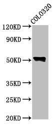 Western Blot Positive WB detected in: Colo320 whole cell lysate All lanes: WAS antibody at 4.6µg/ml Secondary Goat polyclonal to rabbit IgG at 1/50000 dilution Predicted band size: 53 kDa Observed band size: 53 kDa