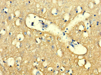 Immunohistochemistry of paraffin-embedded human brain tissue using CSB-PA026011LA01HU at dilution of 1:100