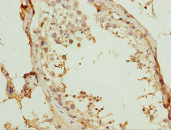 Immunohistochemistry of paraffin-embedded human testis tissue using CSB-PA026035ESR1HU at dilution of 1:100