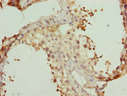 Immunohistochemistry of paraffin-embedded human testis tissue using CSB-PA026035ESR2HU at dilution of 1:100