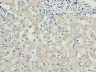 Immunohistochemistry of paraffin-embedded human liver tissue using CSB-PA026077LA01HU at dilution of 1:100