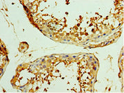 Immunohistochemistry of paraffin-embedded human testis tissue using CSB-PA026120ESR1HU at dilution of 1:100