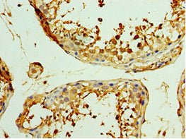 Immunohistochemistry of paraffin-embedded human testis tissue using CSB-PA026120ESR1HU at dilution of 1:100