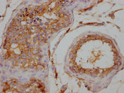 IHC image of CSB-PA026120LA01HU diluted at 1:200 and staining in paraffin-embedded human testis tissue performed on a Leica BondTM system. After dewaxing and hydration, antigen retrieval was mediated by high pressure in a citrate buffer (pH 6.0)....