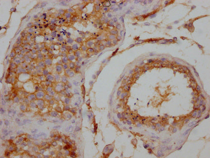 IHC image of CSB-PA026120LA01HU diluted at 1:200 and staining in paraffin-embedded human testis tissue performed on a Leica BondTM system. After dewaxing and hydration, antigen retrieval was mediated by high pressure in a citrate buffer (pH 6.0)....
