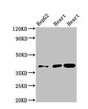 Western Blot Positive WB detected in: HepG2 whole cell lysate, Rat heart tissue, Mouse heart tissue All lanes: WISP3 antibody at 3.5µg/ml Secondary Goat polyclonal to rabbit IgG at 1/50000 dilution Predicted band size: 40, 42 kDa Observed band siz...