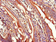 Immunohistochemistry of paraffin-embedded human small intestine tissue using CSB-PA026128LA01HU at dilution of 1:100