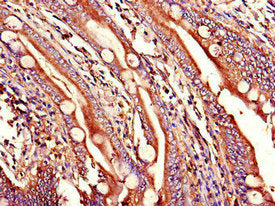 Immunohistochemistry of paraffin-embedded human small intestine tissue using CSB-PA026128LA01HU at dilution of 1:100