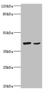 Western blot All lanes: Protein Wnt-2 antibody at 2ug/ml Lane 1: HepG2 whole cell lysate Lane 2: MCF-7 whole cell lysate Secondary Goat polyclonal to rabbit IgG at 1/10000 dilution Predicted band size: 40 kDa Observed band size: 40 kDa