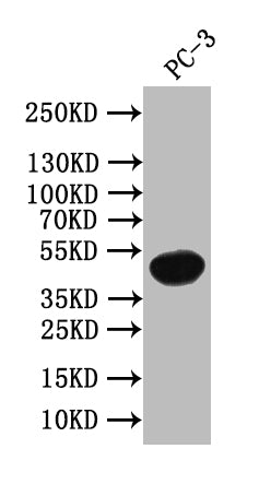 Western Blot Positive WB detected in: PC-3 whole cell lysate All lanes: WNT5A antibody at 1:1000 Secondary Goat polyclonal to rabbit IgG at 1/50000 dilution Predicted band size: 43 kDa Observed band size: 43 kDa