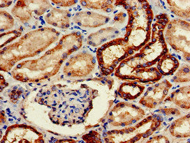 Immunohistochemistry of paraffin-embedded human kidney tissue using CSB-PA026168LA01HU at dilution of 1:100