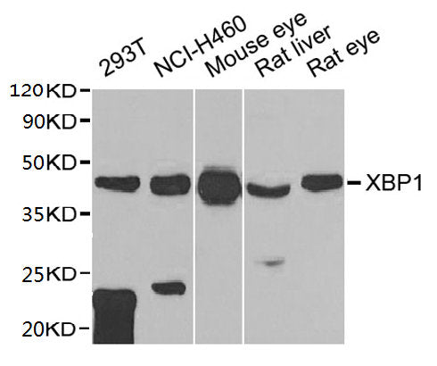 Western blot All lanes: XBP1 antibody at 1:1000 dilution Lane 1: 293T whole cell lysate Lane 2: NCI-H460 whole cell lysate Lane 3: Mouse eye tissue Lane 4: Rat liver tissue Lane 5: Rat eye tissue Secondary Goat polyclonal to rabbit IgG at 1/10000...