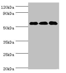 Western blot All lanes: XIAP antibody at 3µg/ml Lane 1: HepG2 whole cell lysate Lane 2: MCF-7 whole cell lysate Lane 3: PC-3 whole cell lysate Secondary Goat polyclonal to rabbit IgG at 1/10000 dilution Predicted band size: 57 kDa Observed band si...