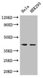Western Blot Positive WB detected in: Hela whole cell lysate, HEK293 whole cell lysate All lanes: ACTG1 antibody at 3ug/ml Secondary Goat polyclonal to rabbit IgG at 1/50000 dilution Predicted band size: 42 kDa Observed band size: 42 kDa