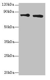 Western blot All lanes: XRCC5 antibody at 6µg/ml Lane 1: HepG2 whole cell lysate Lane 2: Hela whole cell lysate Secondary Goat polyclonal to rabbit IgG at 1/10000 dilution Predicted band size: 83 kDa Observed band size: 83 kDa