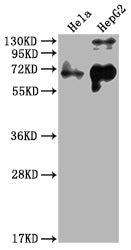 Western Blot Positive WB detected in: Hela whole cell lysate, HepG2 whole cell lysate All lanes: YAP1 antibody at 1:2000 Secondary Goat polyclonal to rabbit IgG at 1/50000 dilution Predicted band size: 55, 53, 49, 37, 49, 50, 51, 54 kDa Observed b...