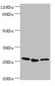 Western blot All lanes: YEATS4 antibody at 1.44µg/ml Lane 1: A549 whole cell lysate Lane 2: Rat gonad tissue Lane 3: U251 whole cell lysate Secondary Goat polyclonal to rabbit IgG at 1/10000 dilution Predicted band size: 26 kDa Observed band size:...