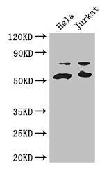 Western Blot Positive WB detected in: Hela whole cell lysate, Jurkat whole cell lysate All lanes: YES1 antibody at 3.2ug/ml Secondary Goat polyclonal to rabbit IgG at 1/50000 dilution Predicted band size: 61 kDa Observed band size: 61, 70 kDa