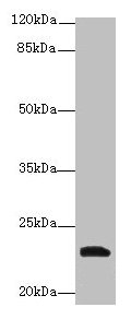 Western blot All lanes: YKT6 antibody at 12µg/ml + A549 whole cell lysate Secondary Goat polyclonal to rabbit IgG at 1/10000 dilution Predicted band size: 23, 19 kDa Observed band size: 23 kDa