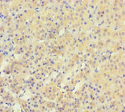 Immunohistochemistry of paraffin-embedded human adrenal gland tissue using CSB-PA026272LA01HU at dilution of 1:100