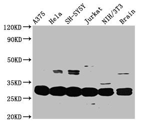 Western Blot Positive WB detected in: A375 whole cell lysate, Hela whole cell lysate, SH-SY5Y whole cell lysate, Jurkat whole cell lysate, NIH/3T3 whole cell lysate, Mouse brain tissue All lanes: YWHAE antibody at 3.3µg/ml Secondary Goat polyclona...