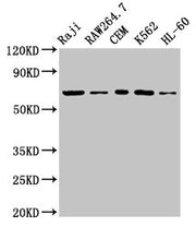 Western Blot Positive WB detected in: Raji whole cell lysate, RAW264.7 whole cell lysate, CEM whole cell lysate, K562 whole cell lysate, HL60 whole cell lysate All lanes: Zap70 antibody at 3.2µg/ml Secondary Goat polyclonal to rabbit IgG at 1/5000...