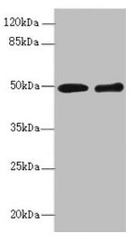 Western blot All lanes: ZBTB25 antibody at 1.41µg/ml Lane 1: MCF-7 whole cell lysate Lane 2: Hela whole cell lysate Secondary Goat polyclonal to rabbit IgG at 1/10000 dilution Predicted band size: 49 kDa Observed band size: 49 kDa
