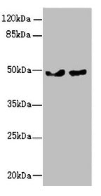 Western blot All lanes: ZBTB25 antibody at 0.43µg/ml Lane 1: MCF-7 whole cell lysate Lane 2: Hela whole cell lysate Secondary Goat polyclonal to rabbit IgG at 1/10000 dilution Predicted band size: 49 kDa Observed band size: 49 kDa