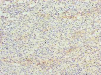 Immunohistochemistry of paraffin-embedded human spleen tissue using CSB-PA026340DSR1HU at dilution of 1:100