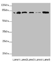 Western blot All lanes: ZBTB48 antibody at 0.31µg/ml Lane 1: 293T whole cell lysate Lane 2: K562 whole cell lysate Lane 3: HepG2 whole cell lysate Lane 4: U251 whole cell lysate Lane 5: Mouse liver tissue Secondary Goat polyclonal to rabbit IgG at...