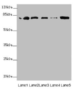 Western blot All lanes: ZBTB48 antibody at 0.31µg/ml Lane 1: 293T whole cell lysate Lane 2: K562 whole cell lysate Lane 3: HepG2 whole cell lysate Lane 4: U251 whole cell lysate Lane 5: Mouse liver tissue Secondary Goat polyclonal to rabbit IgG at...