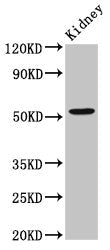 Western Blot Positive WB detected in: Rat kidney tissue All lanes: ZFP36L2 antibody at 2.6ug/ml Secondary Goat polyclonal to rabbit IgG at 1/50000 dilution Predicted band size: 52 kDa Observed band size: 52 kDa
