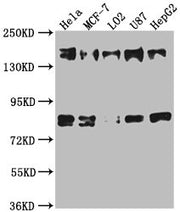 Western Blot Positive WB detected in: Hela whole cell lysate, MCF-7 whole cell lysate, L02 whole cell lysate, U87 whole cell lysate, HepG2 whole cell lysate All lanes: ZFYVE9 antibody at 1:1000 Secondary Goat polyclonal to rabbit IgG at 1/50000 di...