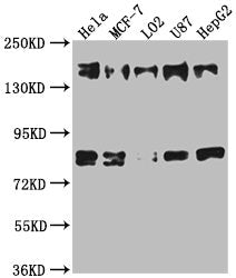 Western Blot Positive WB detected in: Hela whole cell lysate, MCF-7 whole cell lysate, L02 whole cell lysate, U87 whole cell lysate, HepG2 whole cell lysate All lanes: ZFYVE9 antibody at 1:1000 Secondary Goat polyclonal to rabbit IgG at 1/50000 di...